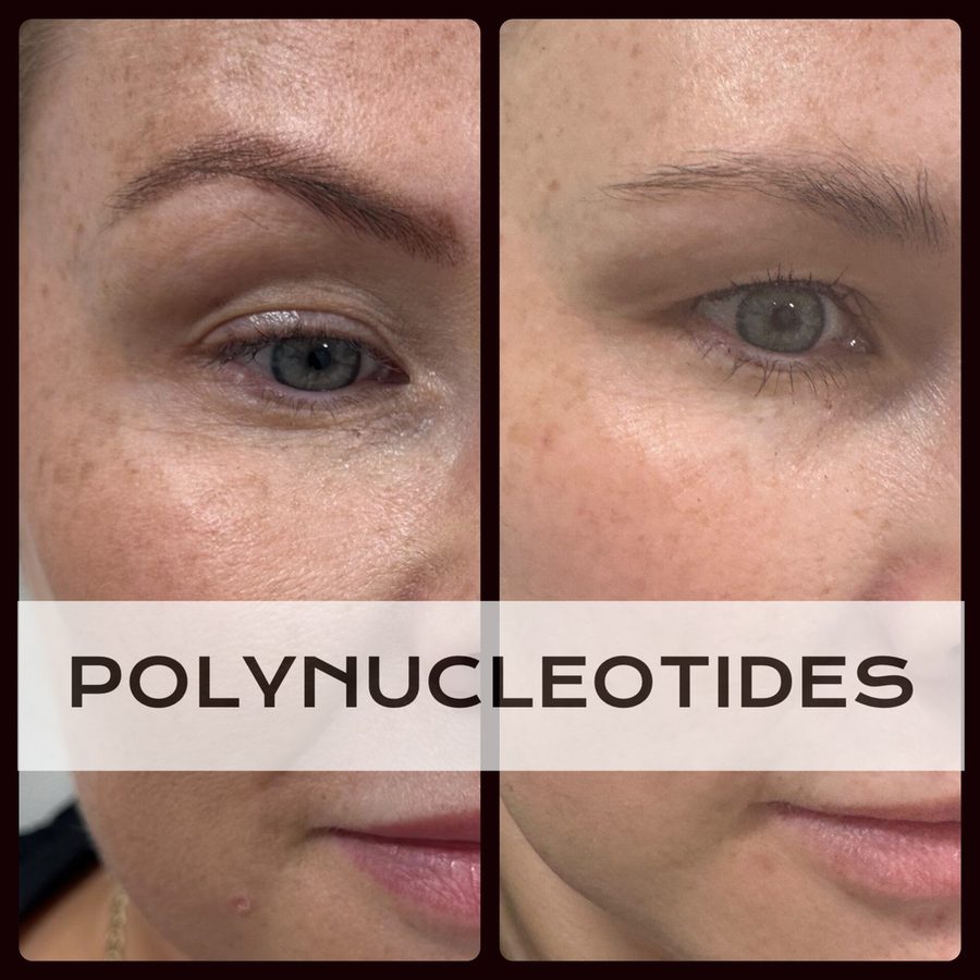 Polynucleotides before and after — Hybridity Aesthetics